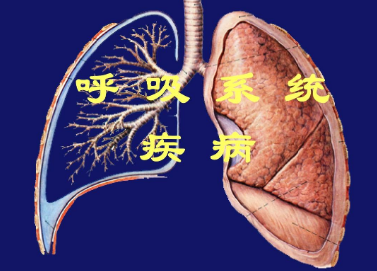 慢阻肺患者已達(dá)近億人 我國(guó)亟待提高呼吸系統(tǒng)疾病防治水平