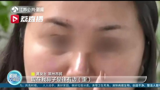 女子在蘇州美萊美容醫(yī)院隆鼻 術(shù)后卻成歪鼻子